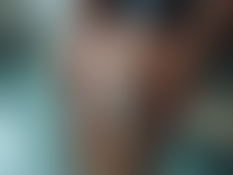 Common Causes of Soft Tissue Injuries and Prevention