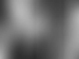 What Causes Osteonecrosis and How to Prevent It By Dr. Kashyap Solanki – Orthopaedic Surgeon, Andheri East, Mumbai