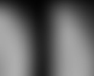 Shoulder Dislocation – Causes, Symptoms, and Recovery By Dr. Kashyap Solanki, Orthopaedic Surgeon, Andheri East, Mumbai