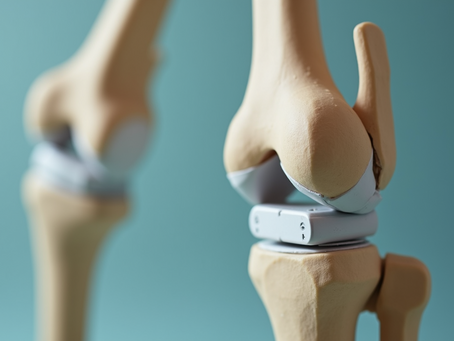 Knee Replacement Surgery: Frequently Asked Questions