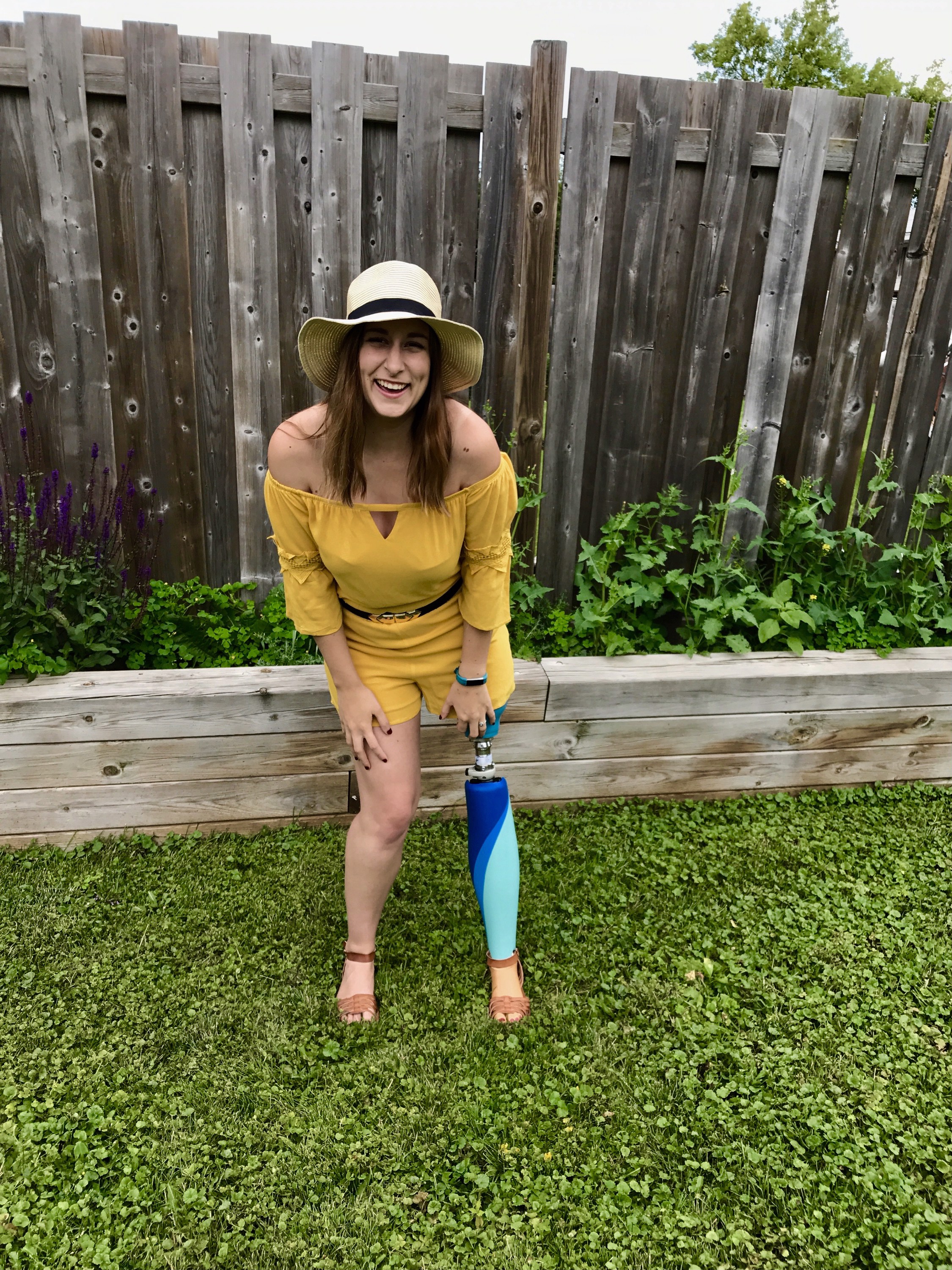 10 Tips for Coping with Becoming an Amputee