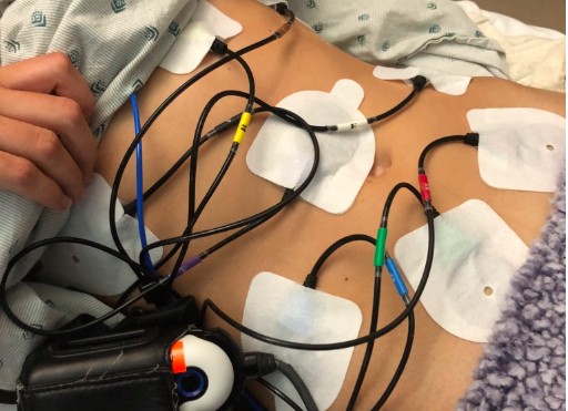 Embracing Your Disability with Ulcerative Colitis