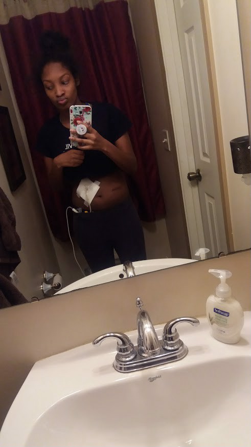 Staying Strong with Multiple Sclerosis & GI Disorders