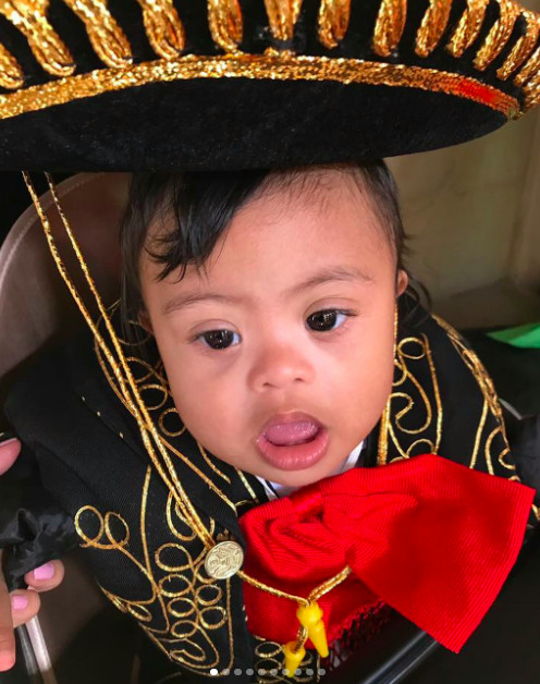 Our Down syndrome Story, Our Diagnosis, Our Son