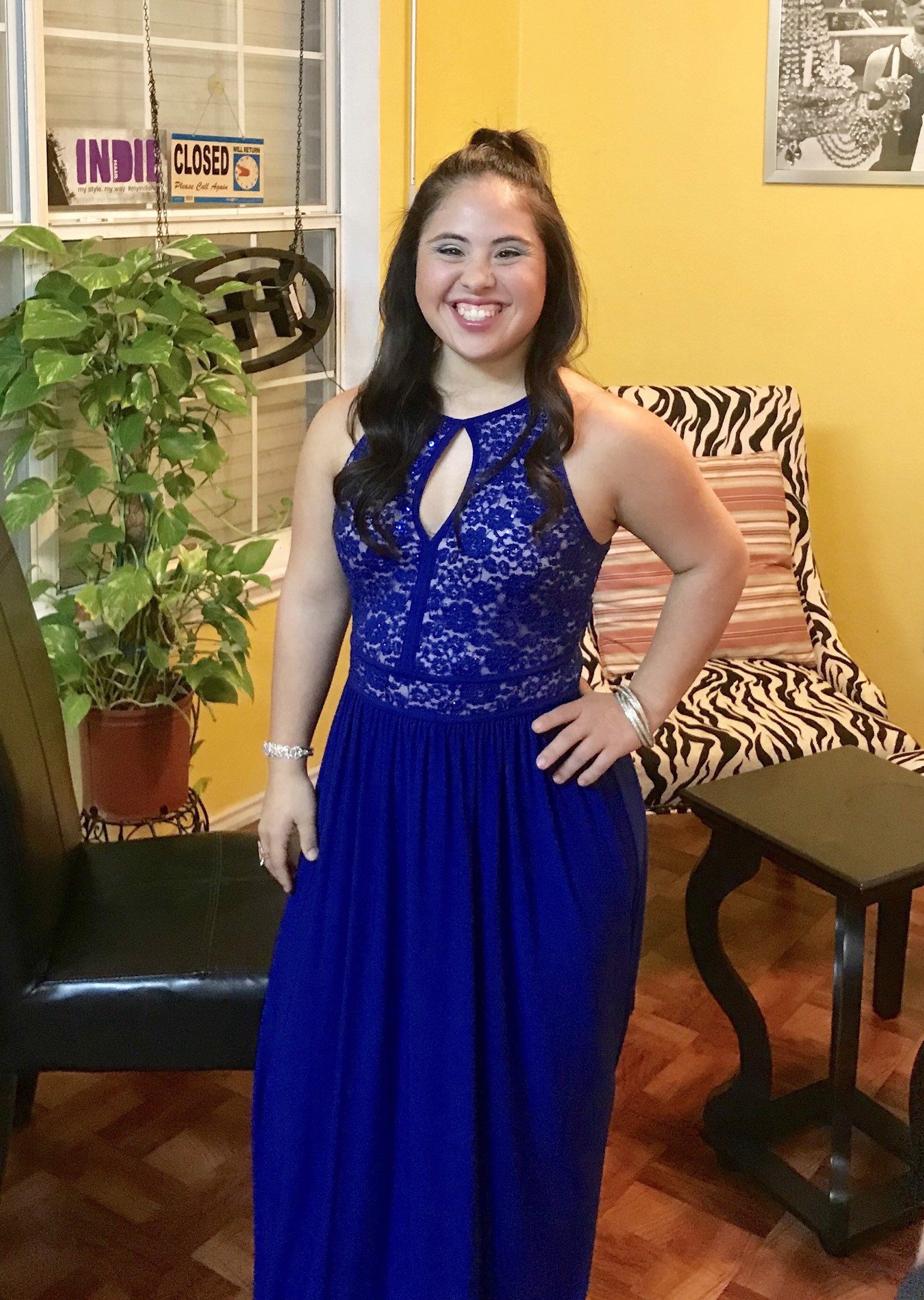 Model with Down Syndrome redefining the image of modeling