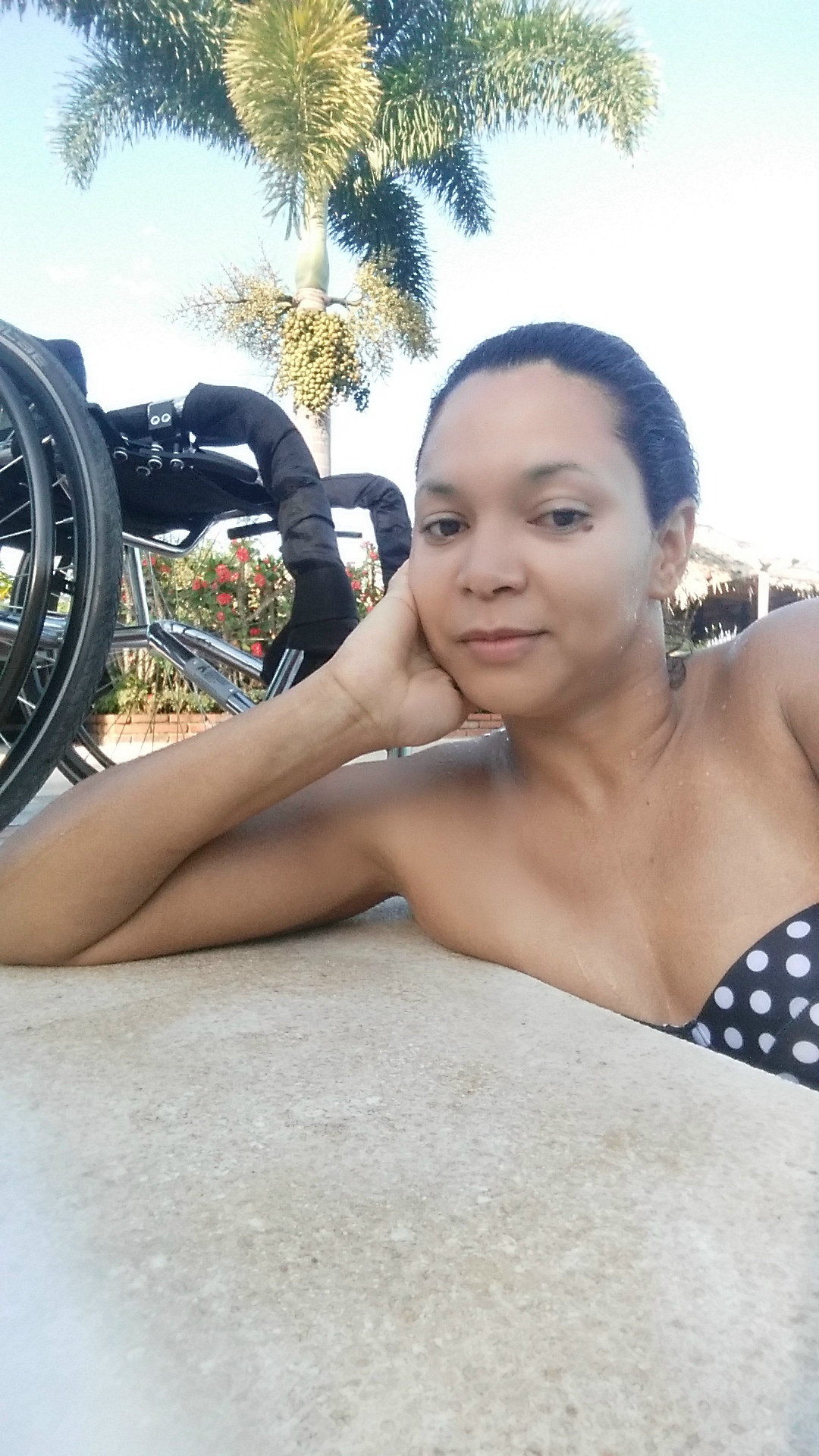 Disabilities Are My Passion