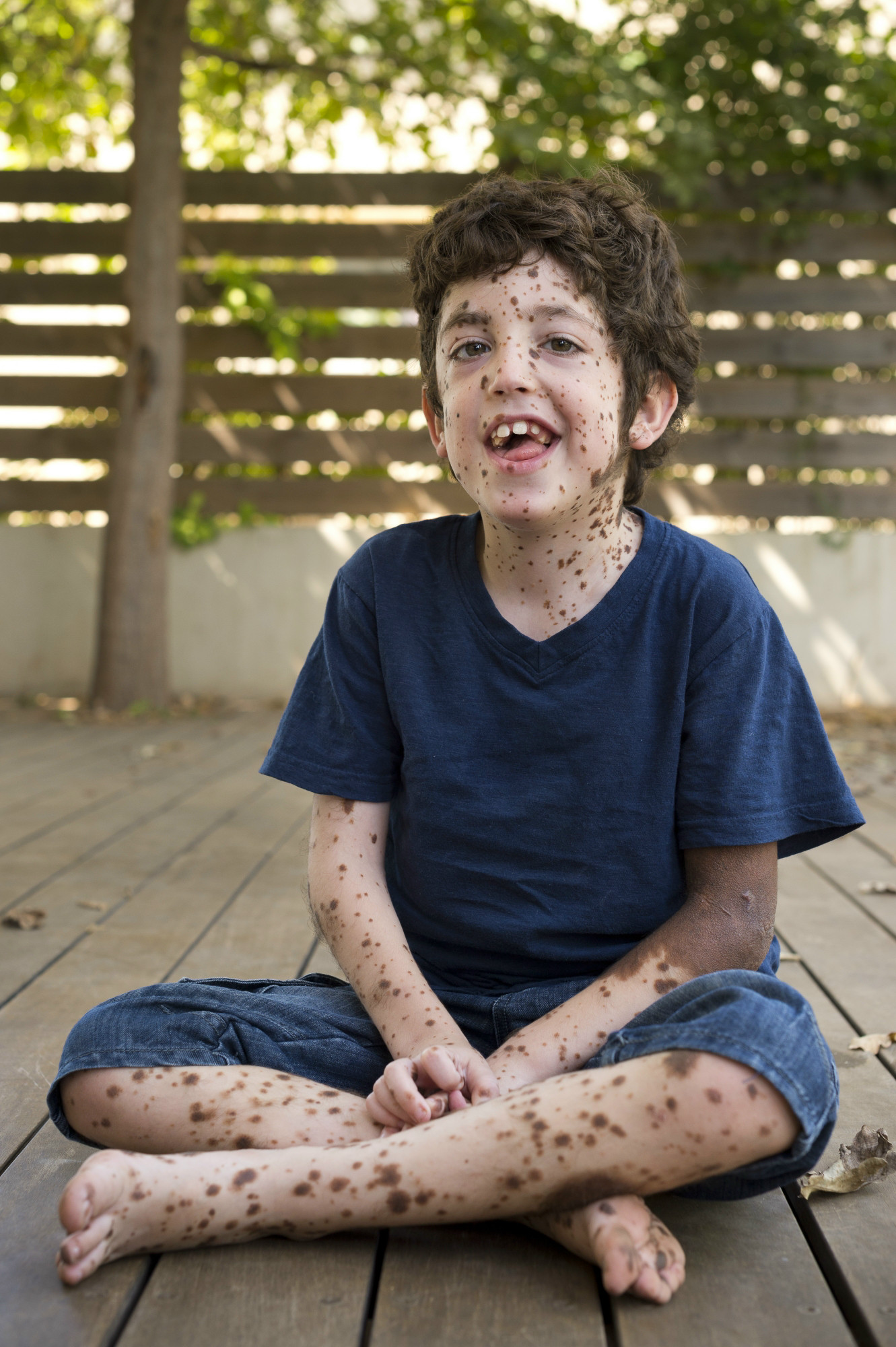 10 tips for Special Needs Siblings