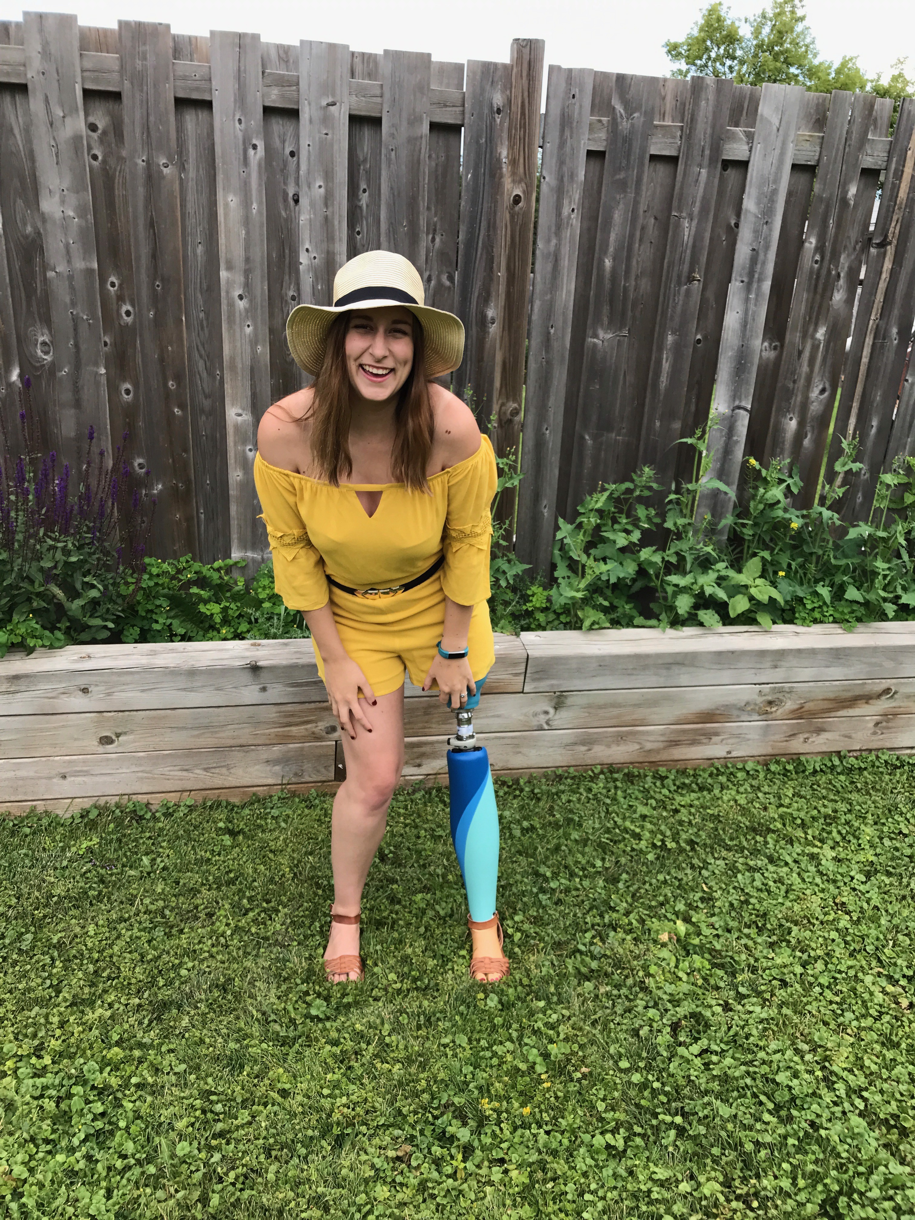 The Only Disability in Life is a Bad Attitude: My Amputee Journey