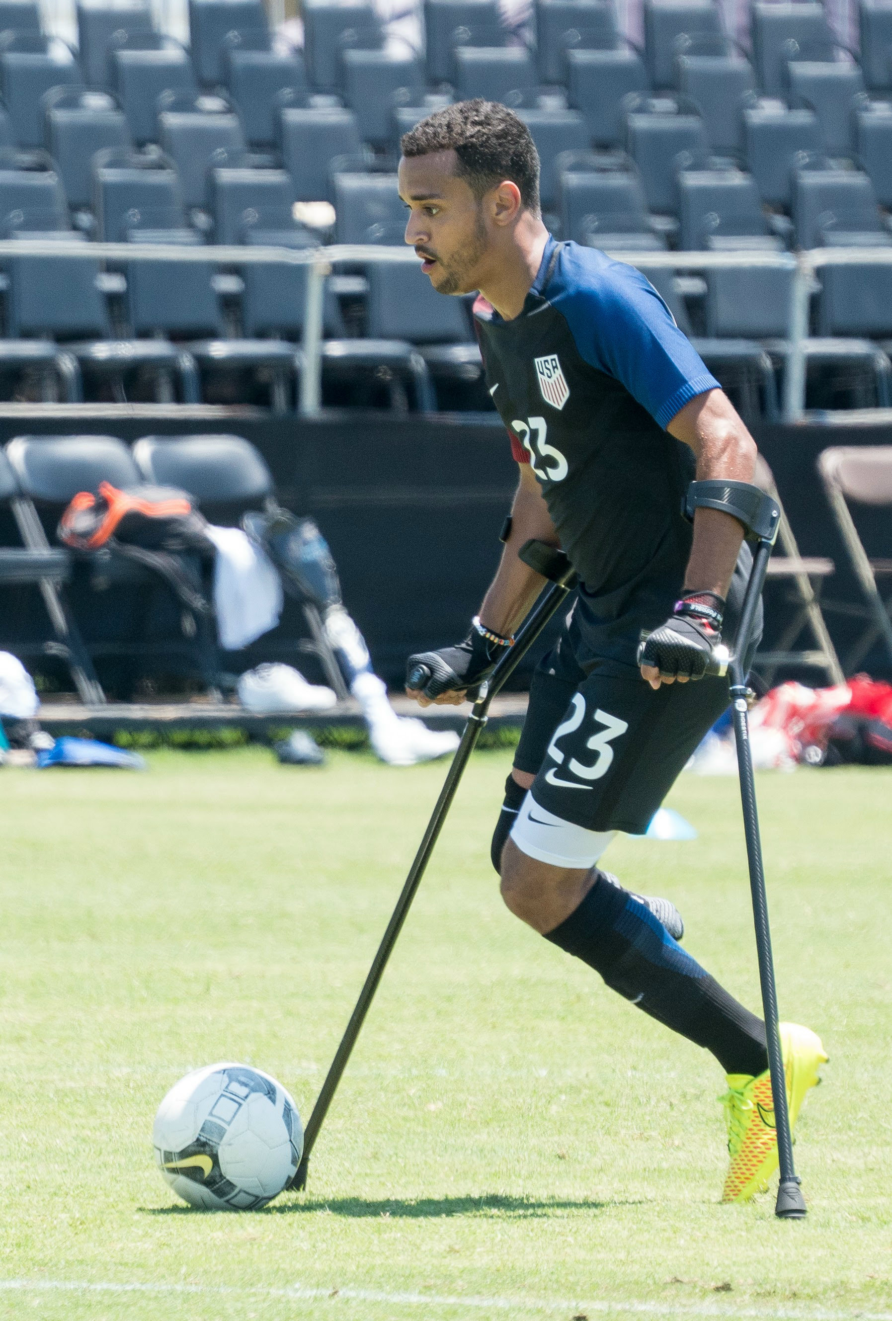 Turning Adversity Into Opportunity: My Amputee Story