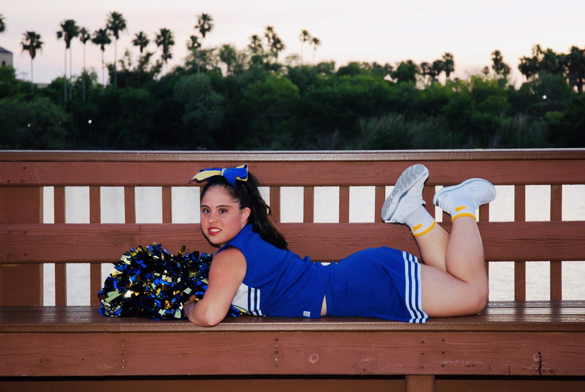 Model with Down Syndrome redefining the image of modeling