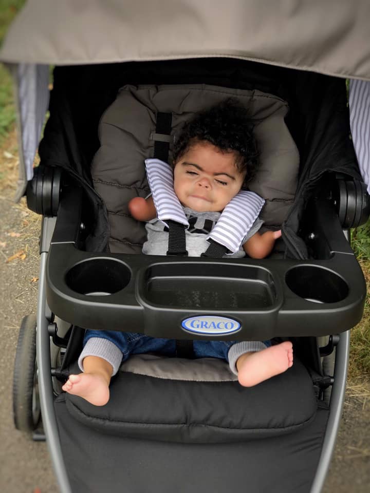 What Is CdLS? | Cornelia de Lange Syndrome