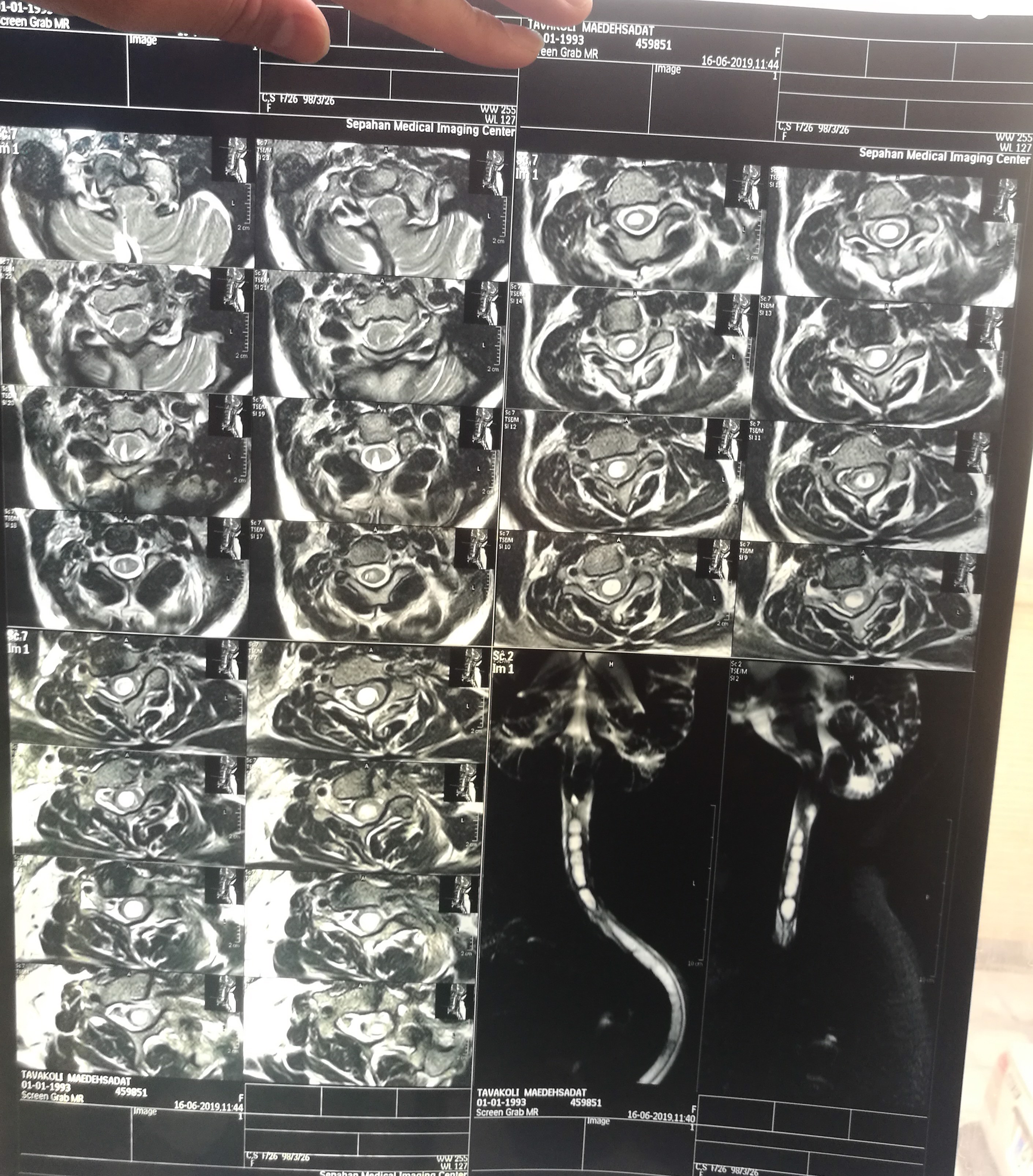 Why I was given 20% chance to live