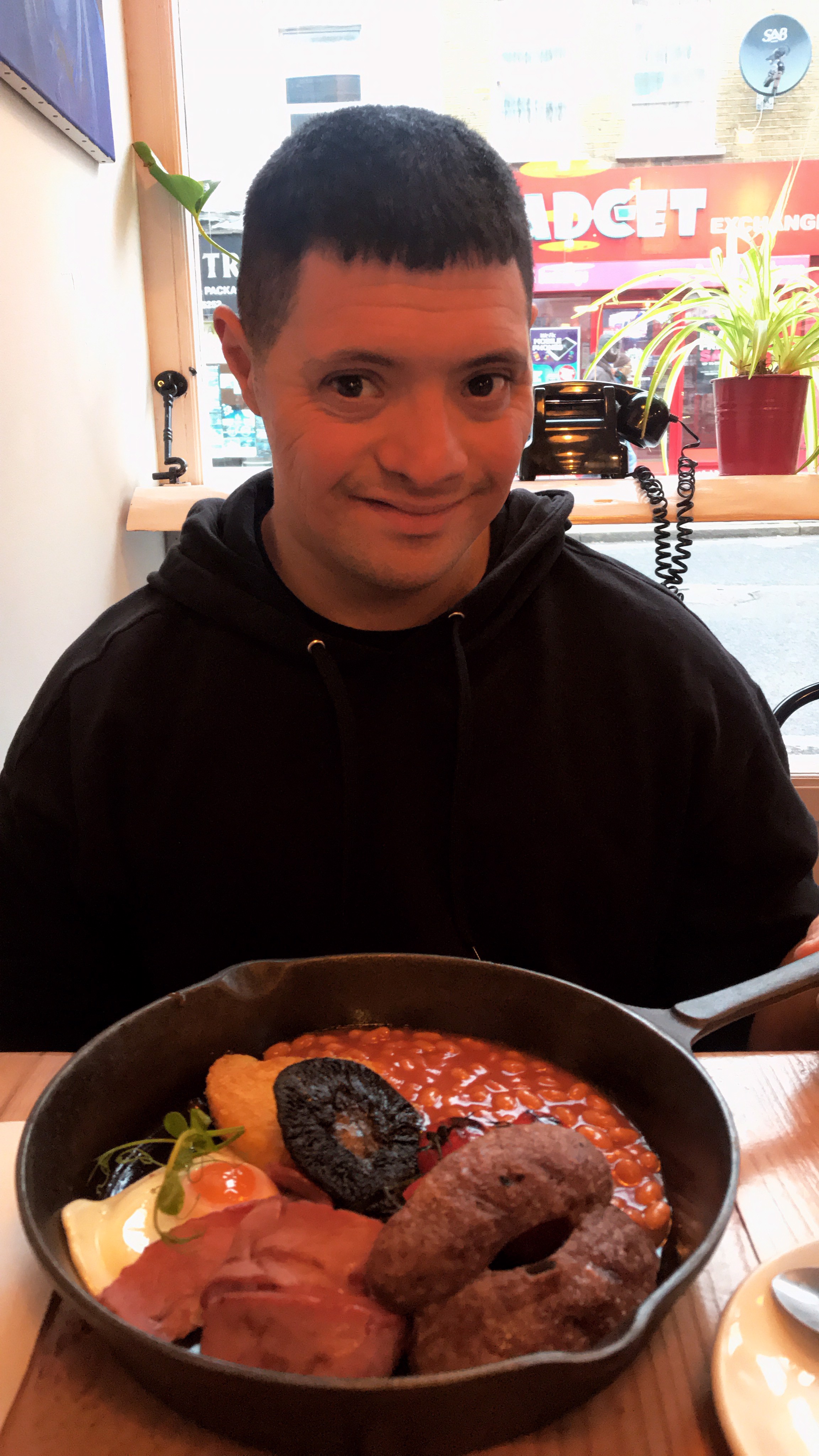 Down syndrome doesn’t make you different