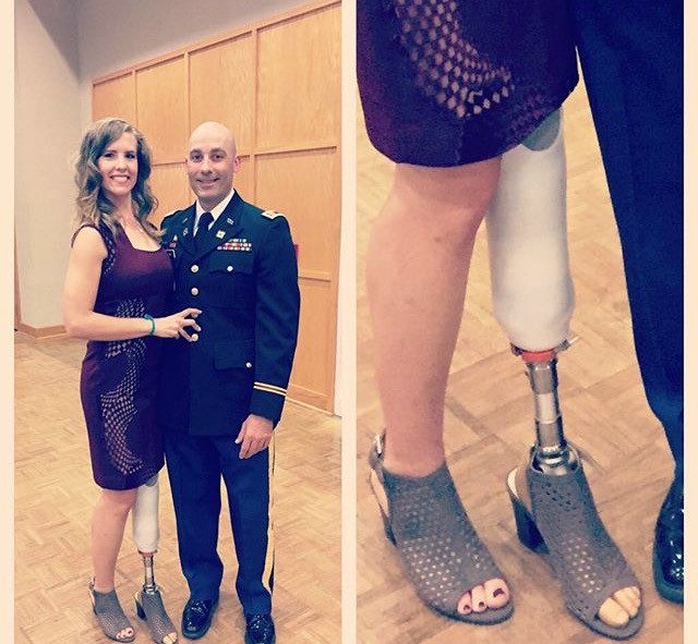 Stroke survivor to amputee