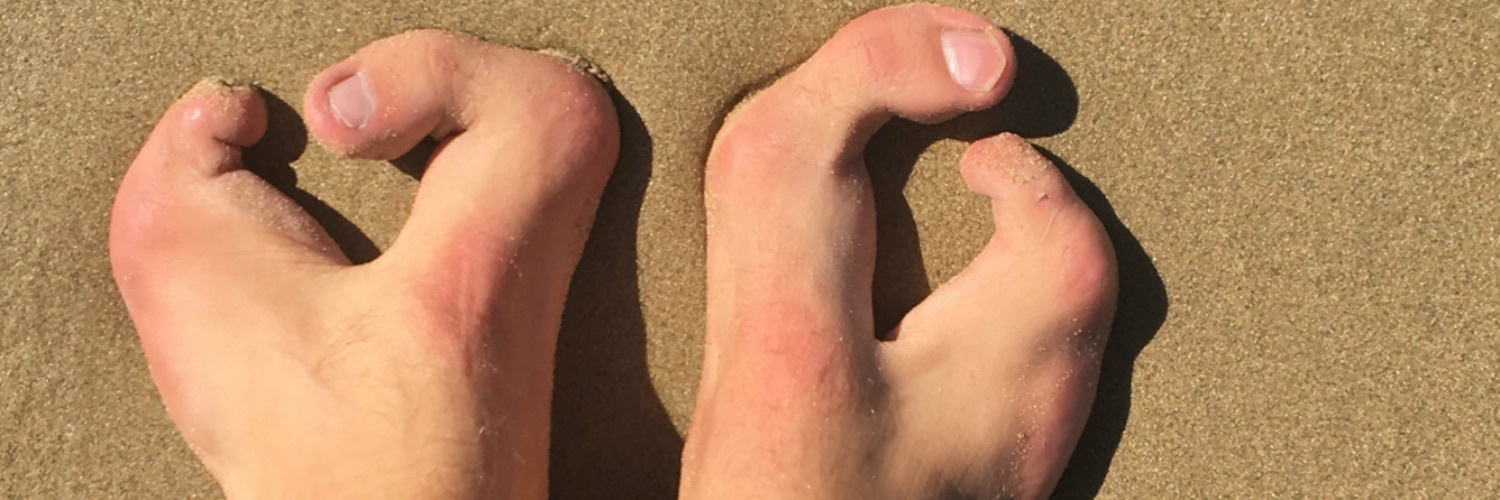 Controlling My Narrative & Owning It With Congenital Differences