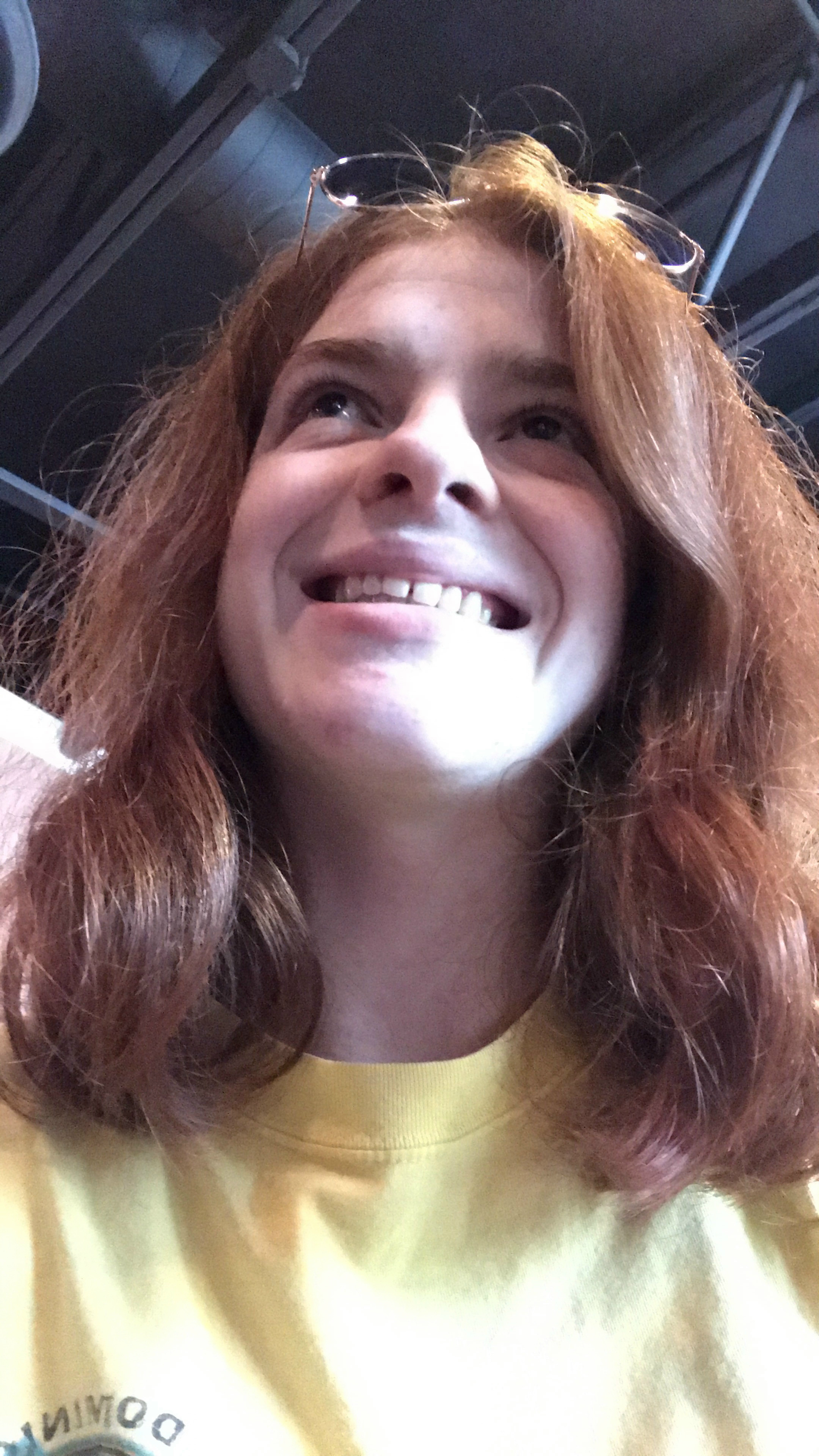 Share Your Sparkle: Living With Cerebral Palsy