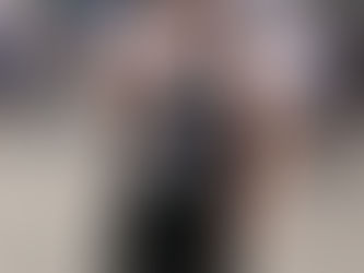 Me vs. Klippel Trenaunay Syndrome