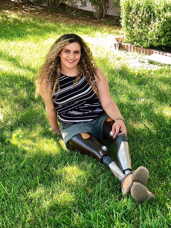 An Amputee in Higher Education