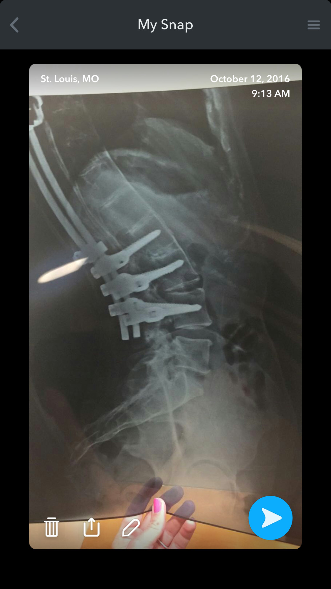 Kristy Wimberly: Ability Is Stronger Than Any Disability