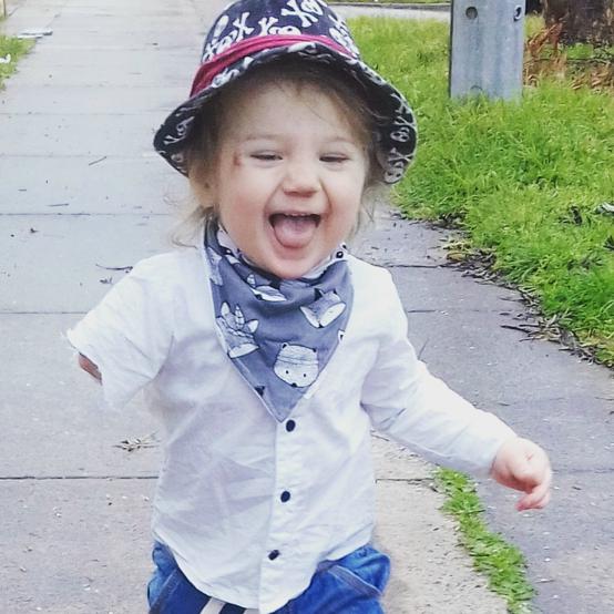 How to Parent A Kid With Limb Difference: Malakye the Magnifient