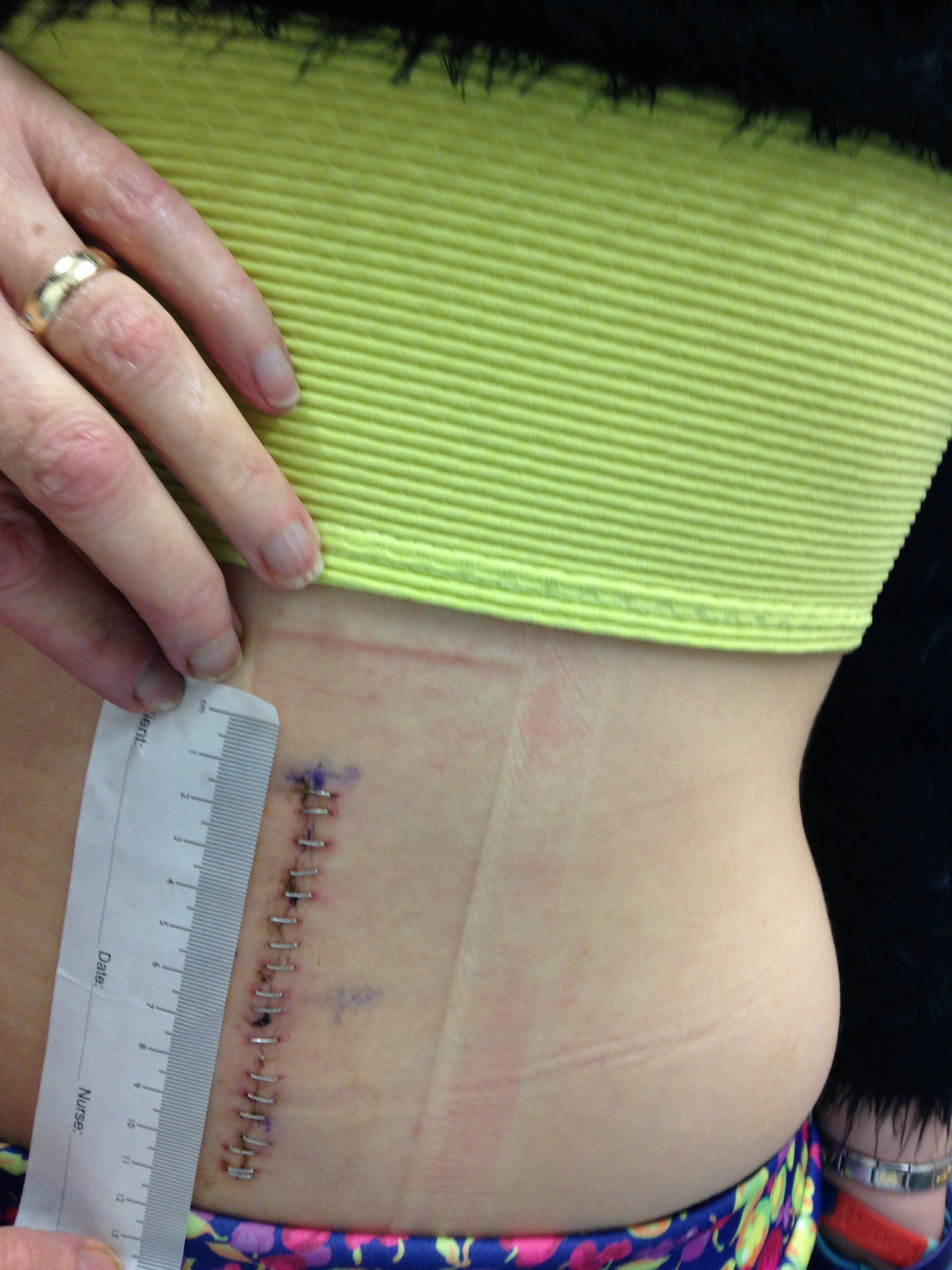 Fighting through my medical journey