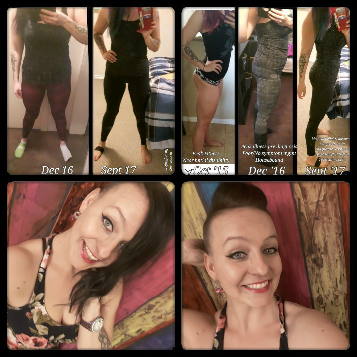 A Glimpse Into the Visibly Invisible Illness