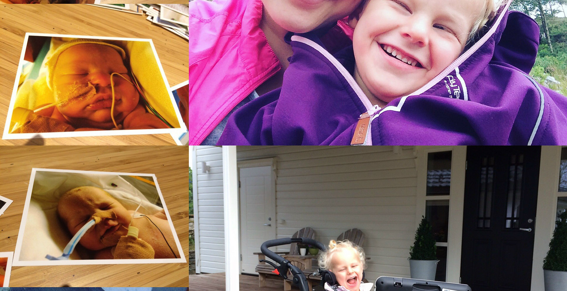 How I've Adapted To A Life With Dyskinetic Cerebral Palsy