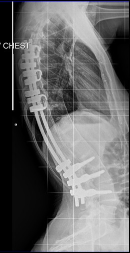 Kristy Wimberly: Ability Is Stronger Than Any Disability