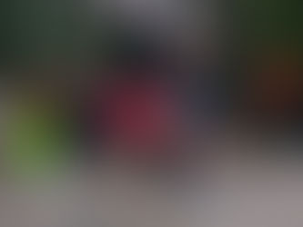 Embracing the Cards You're Dealt: Amputation