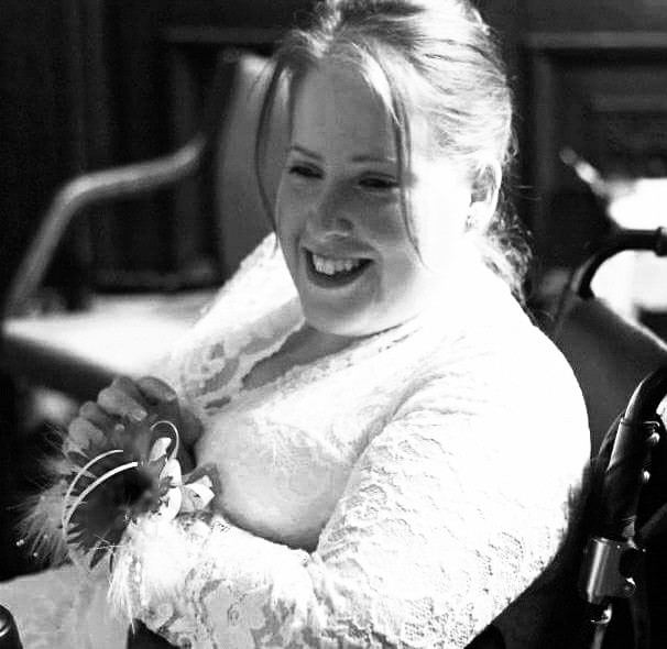 Spina Bifida Has Never Been An Issue For Me