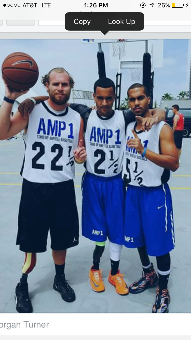 Turning Adversity Into Opportunity: My Amputee Story