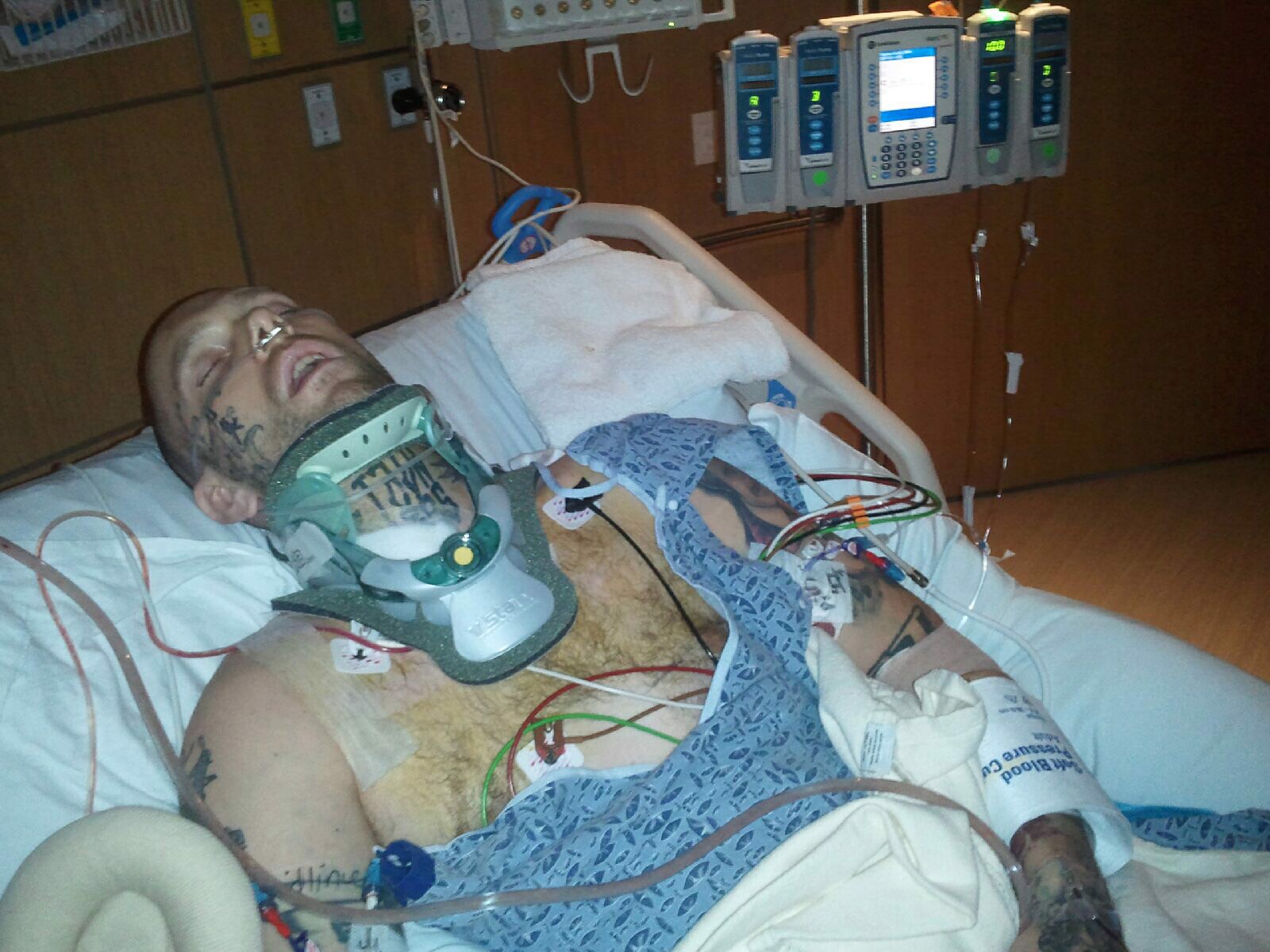 I Was Given a 1% Chance of Walking Again: Becoming Quadriplegic