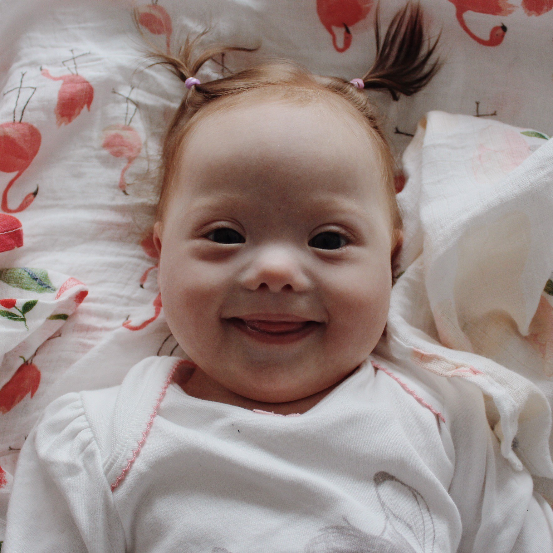 One in a million: One of our twins was born with Down syndrome