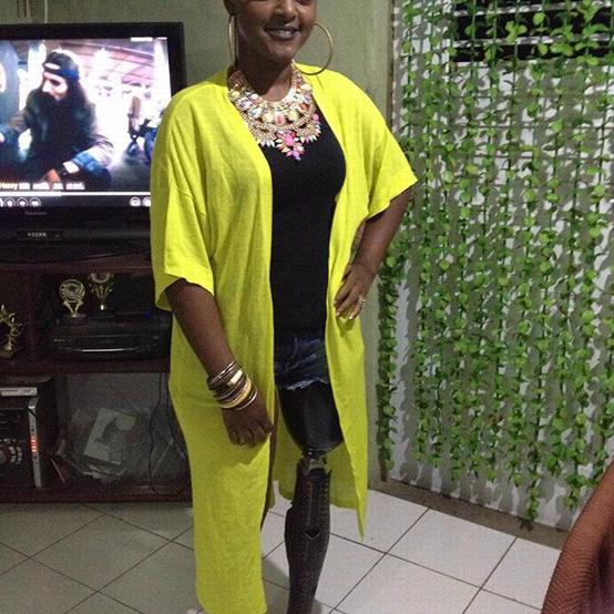 Don't let your disability limit or discourage you