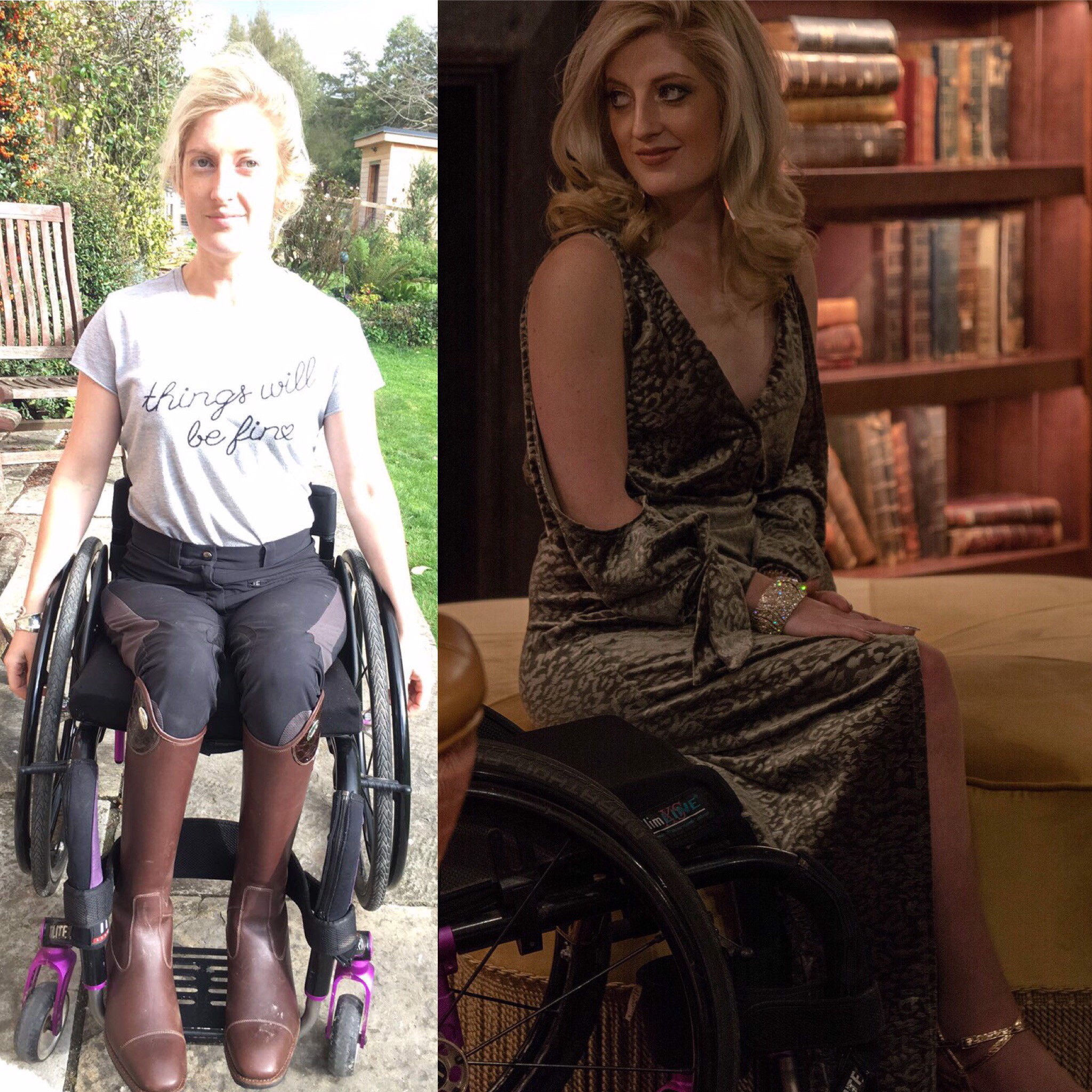 How personal styling helped me overcome a life changing accident