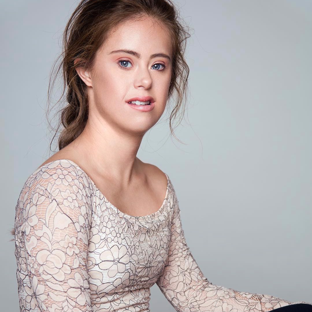 The Making of a "CHAMPION" with Down Syndrome