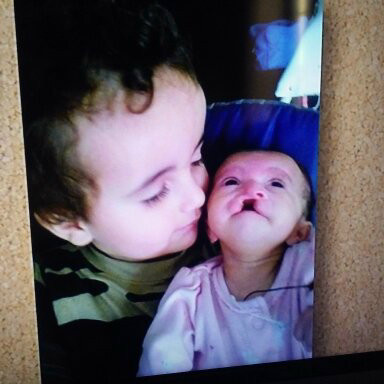 Aerilyn's Life with Trisomy13