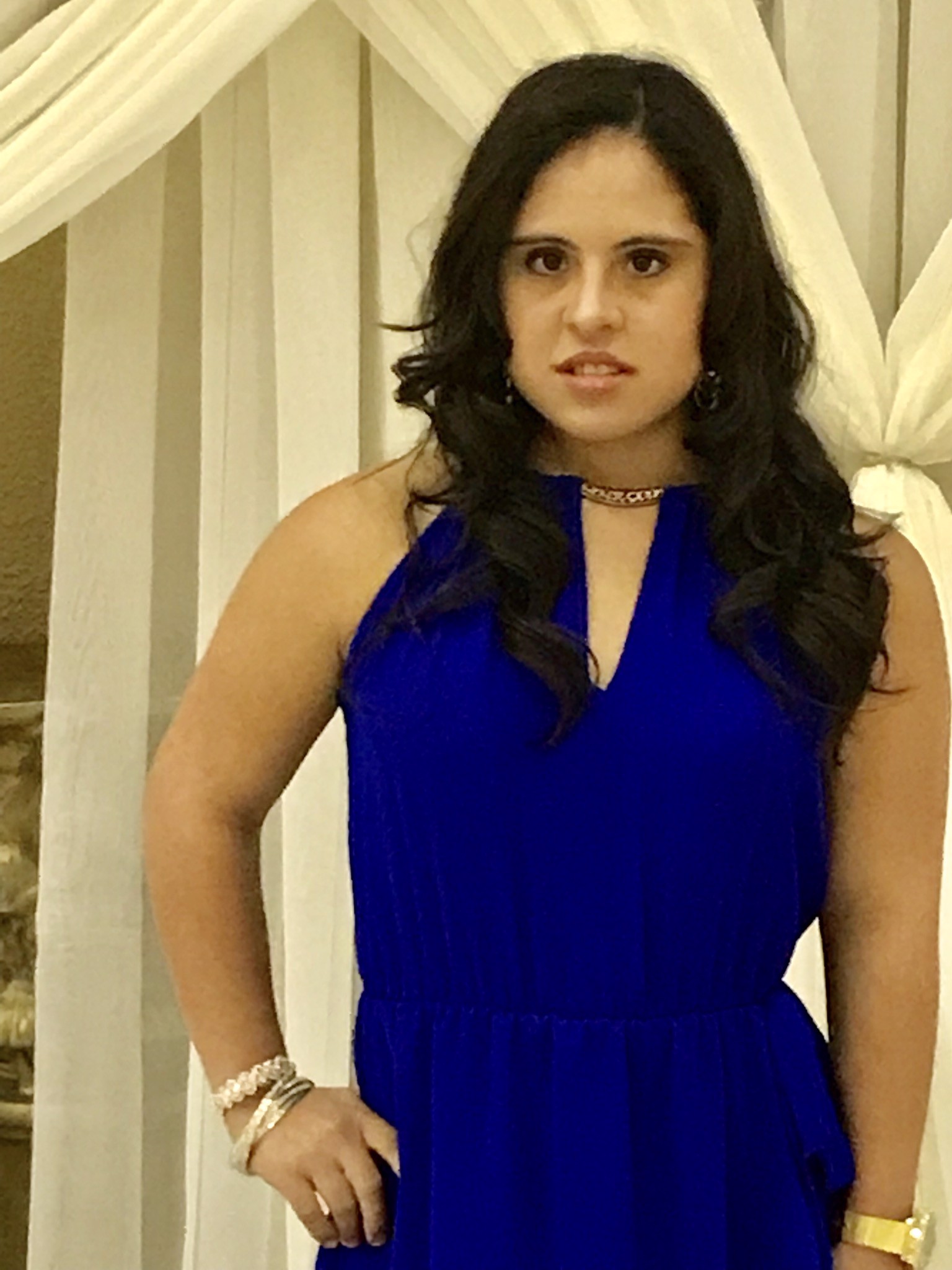 Model with Down Syndrome redefining the image of modeling