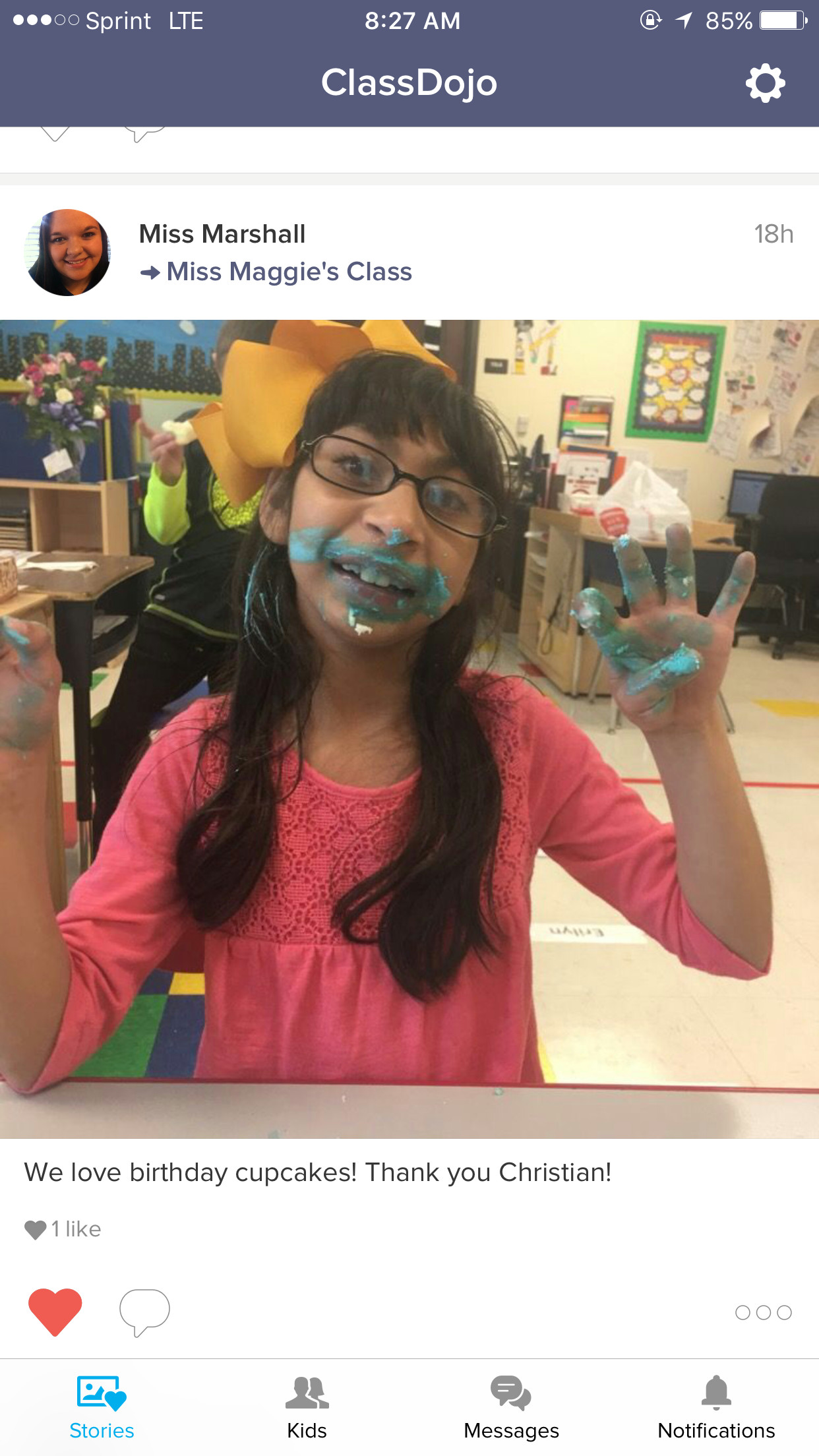 Our Miracle Child Living with Microcephaly