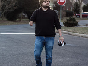 It's About the Right Attitude with a Congenital Limb Differece