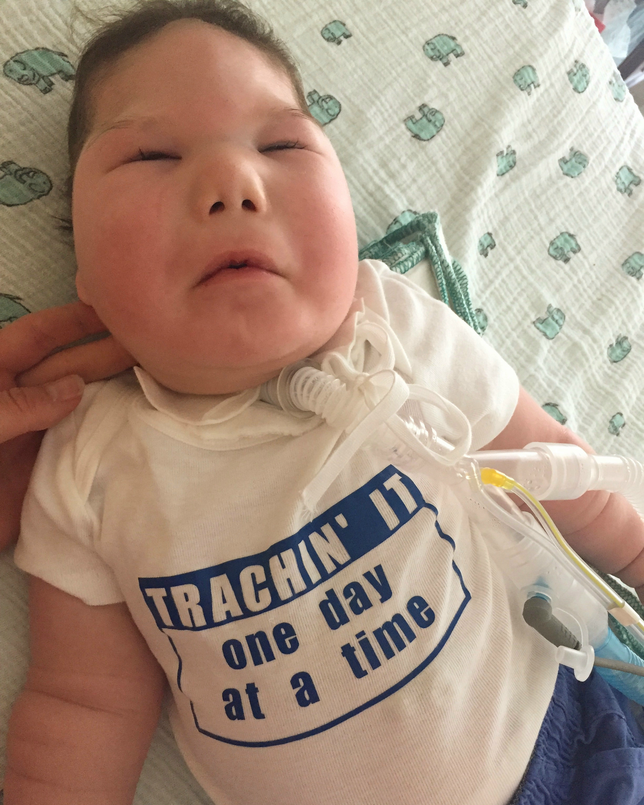 Love No Matter Your Ability: A Muscular Dystrophy Story