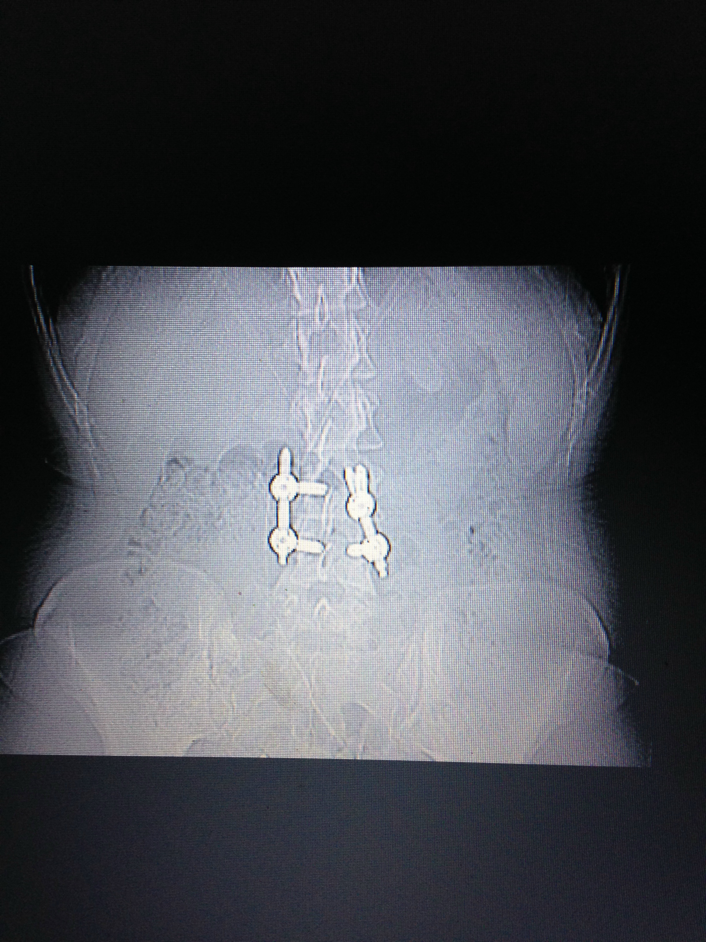 Fighting through my medical journey