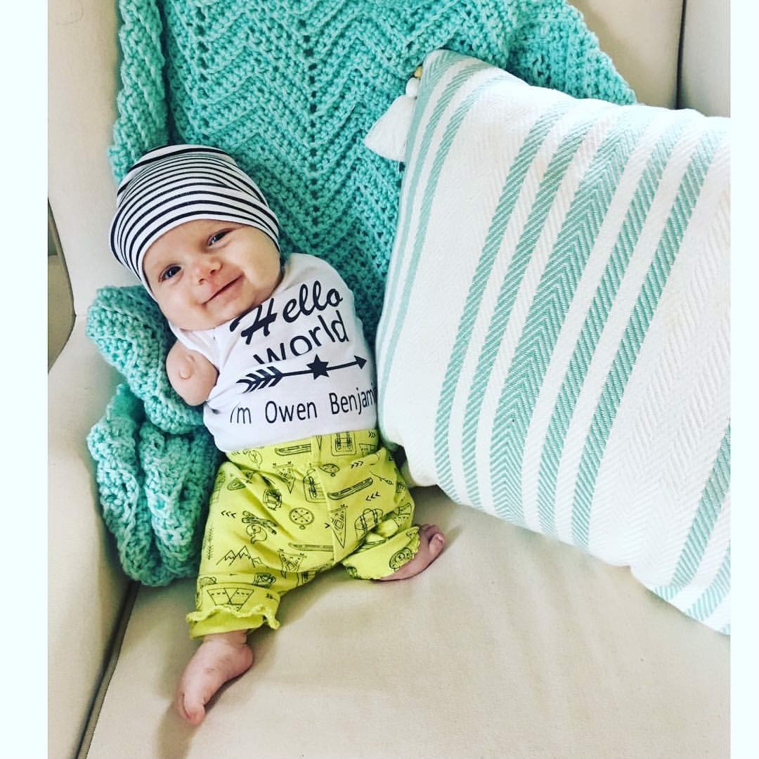The Story of a World Changer With Congenital Limb Differences