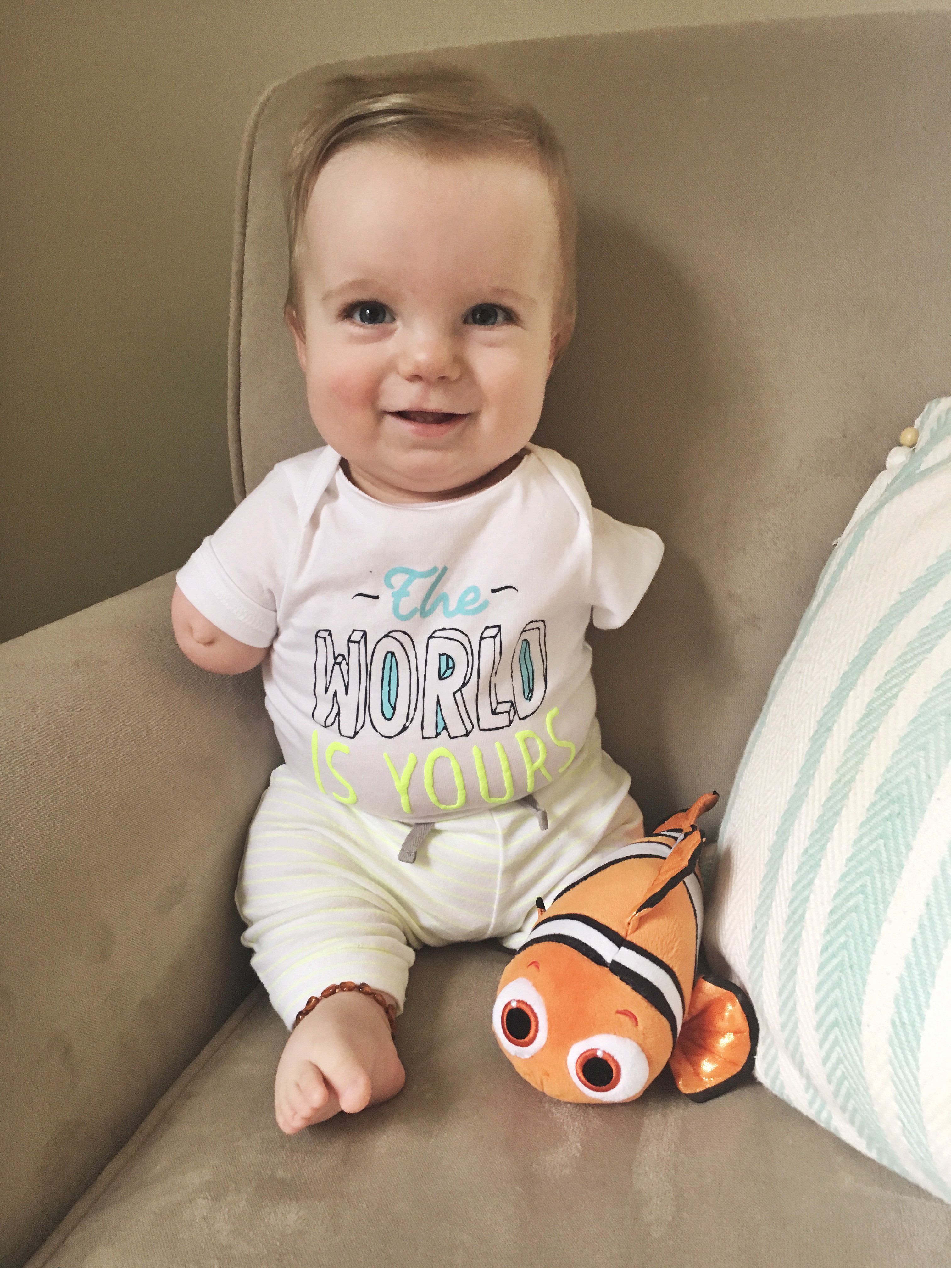 The Story of a World Changer With Congenital Limb Differences