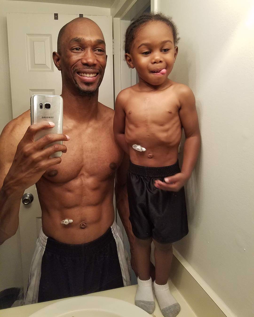 Heartwarming Father and Son Story: Congenital Heart Defect