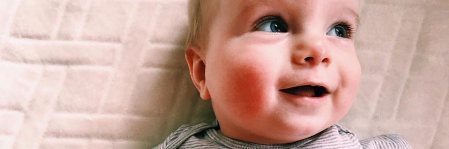 The Story of a World Changer With Congenital Limb Differences
