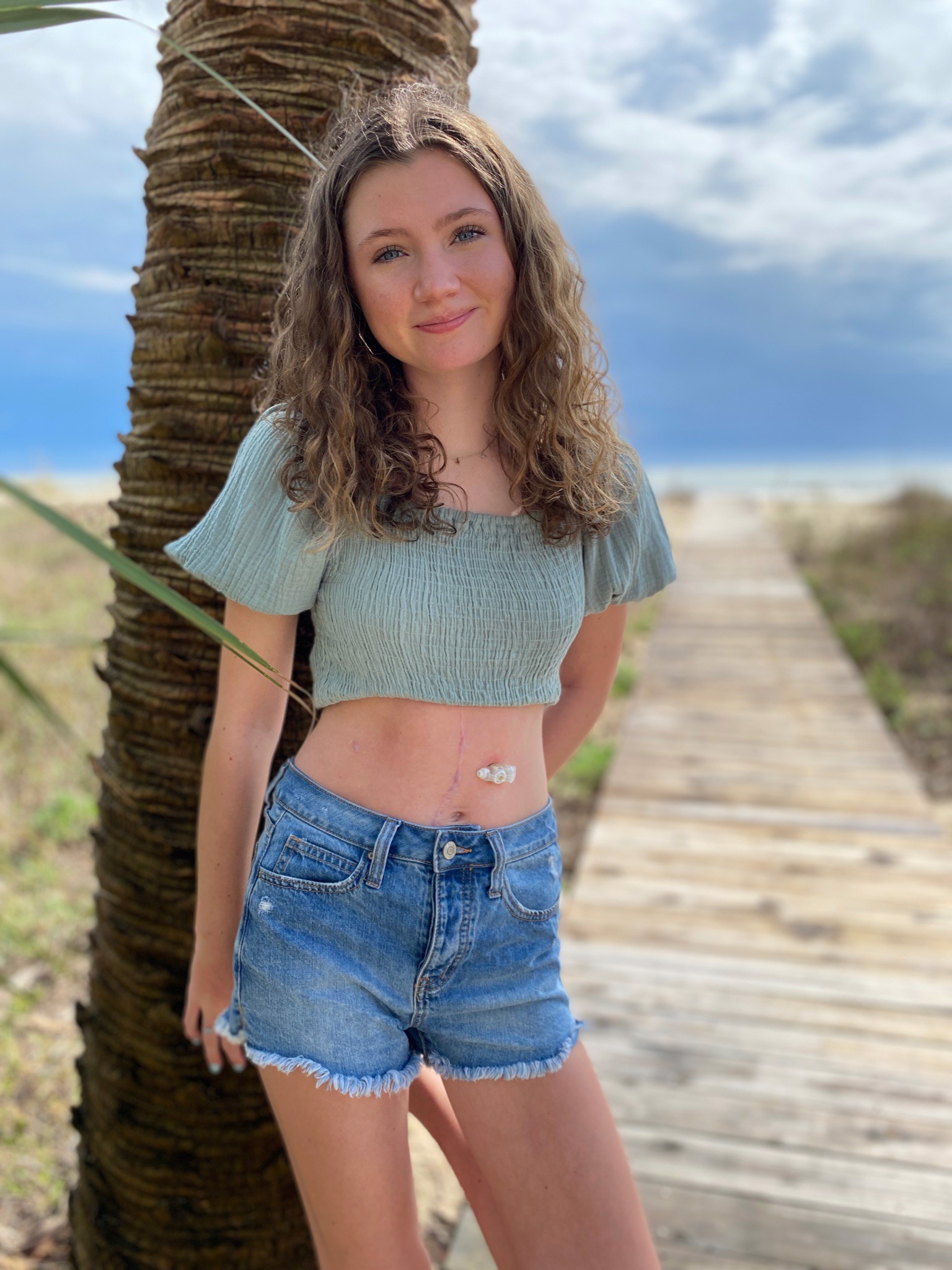 Finding Purpose in My Rare Disease Journey