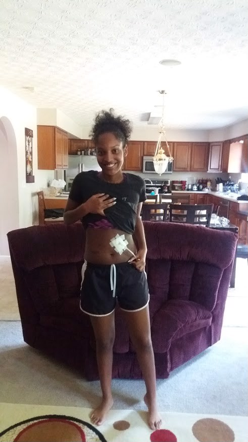 Staying Strong with Multiple Sclerosis & GI Disorders