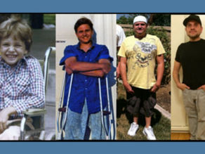 Breaking Barriers NOT Bones: Life With Osteogenesis Imperfecta