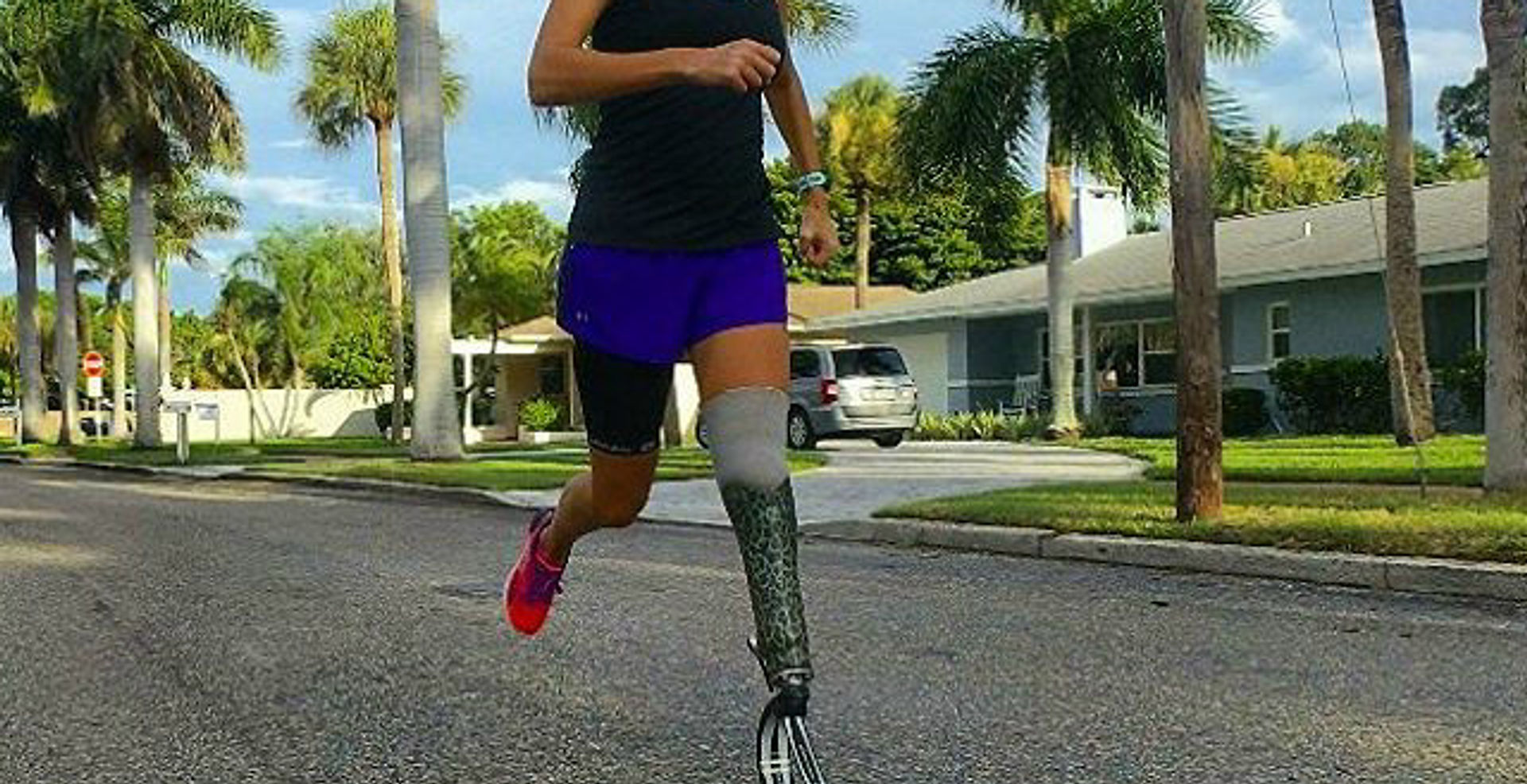 Accept no limits: Amputee Story